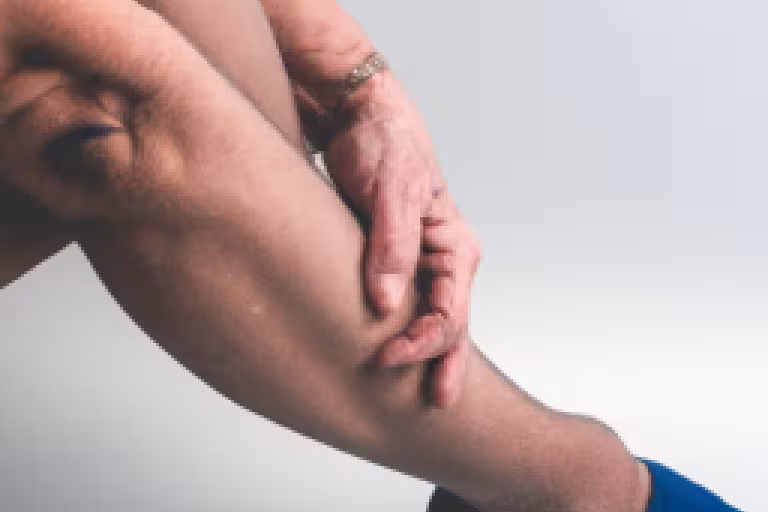 Understanding Deep Vein Thrombosis: Causes, Symptoms, and Treatments